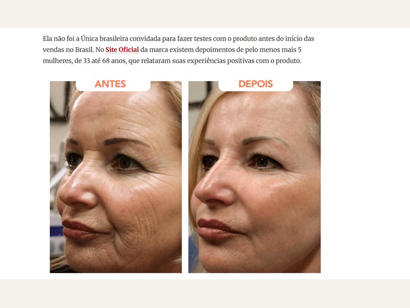 Antes e depois do uso do Salmon PDRN