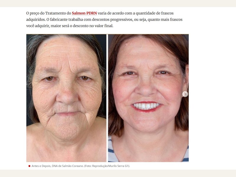 Transformação em 90 dias com Salmon PDRN